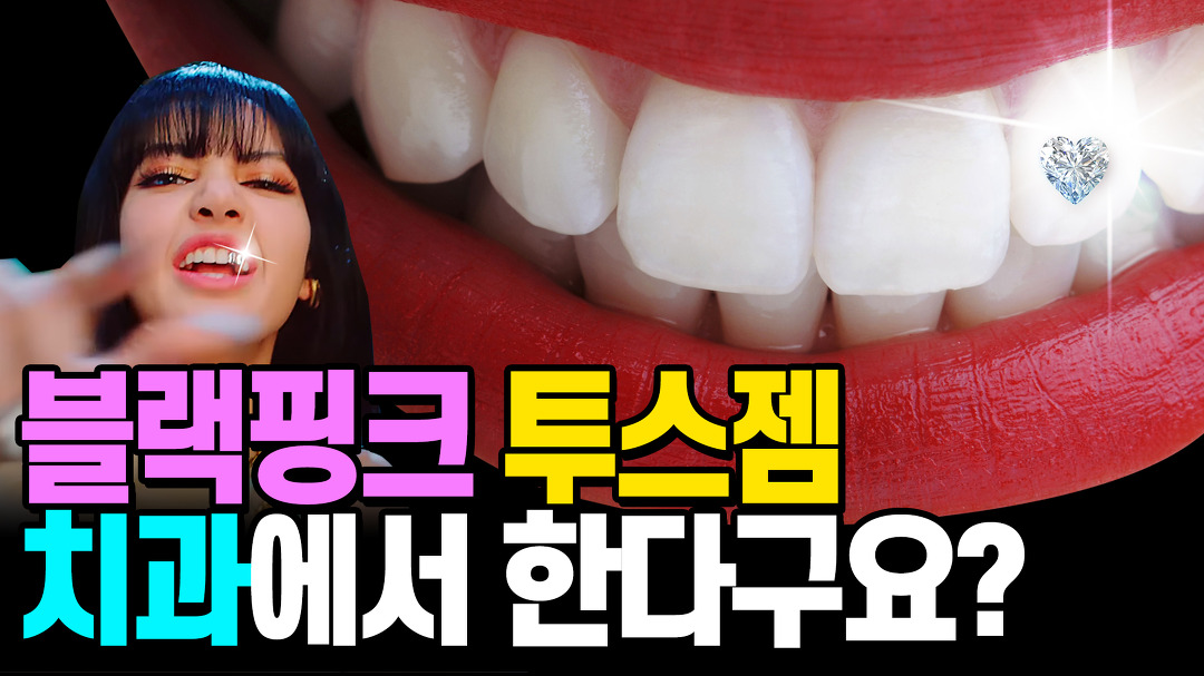 치과에서 치아에 보석을? 블랙핑크도 한 투스젬 투스잼 알려드립니다! - kakaoTV 치과에서 치아에 보석을? 블랙핑크도 한 투스젬 투스잼... 