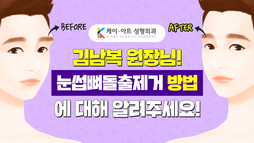 눈썹뼈돌출제거수술 케이아트성형외과 김남복 원장님의 설명! - kakaoTV 눈썹뼈돌출제거수술 케이아트성형외과 김남복 원장님의 설명!