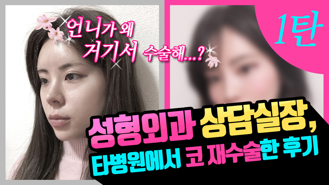 일본 성형외과 실장, 한국에서 코재수술 한 후기 1탄 - kakaoTV 일본 성형외과 실장, 한국에서 코재수술 한 후기 1탄
