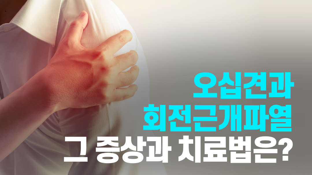 - 면목나은정형외과(중랑구,면목동,면목역)서효성원장 - kakaoTV 오십견 증상과 치료법은? - 면목나은정형외과(중랑구,면목동,면목역)... 