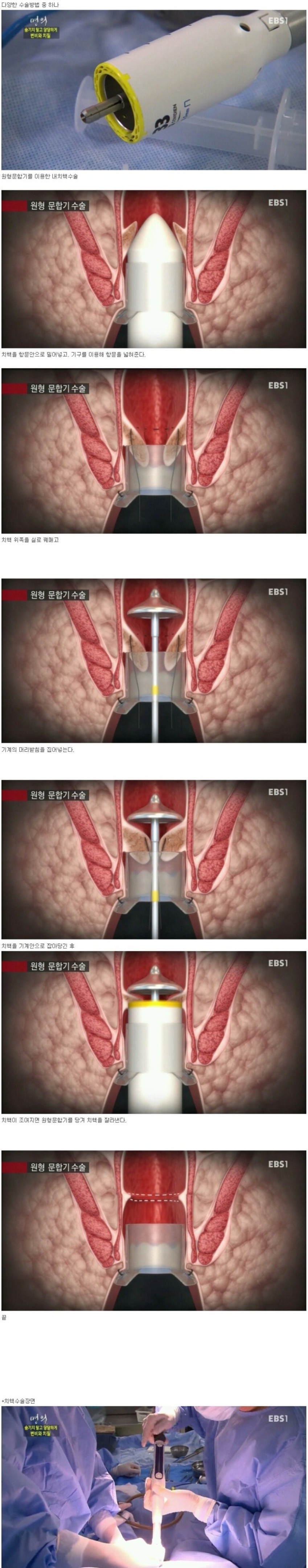 994D2E3359D62DCE091510