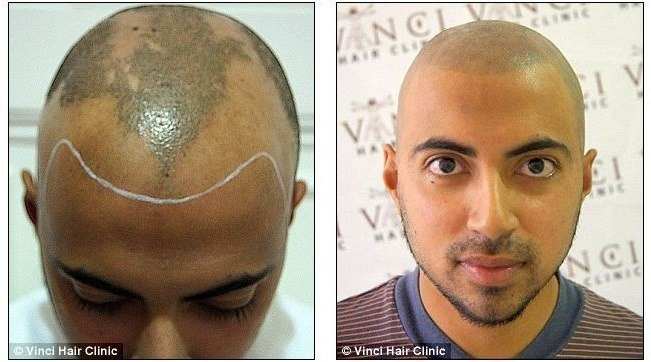 영국에서 유행중이라는 문신 | 인스티즈