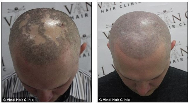 영국에서 유행중이라는 문신 | 인스티즈