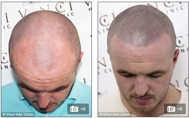 영국에서 유행중이라는 문신 | 인스티즈