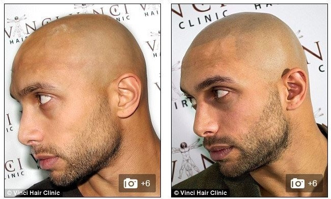 영국에서 유행중이라는 문신 | 인스티즈