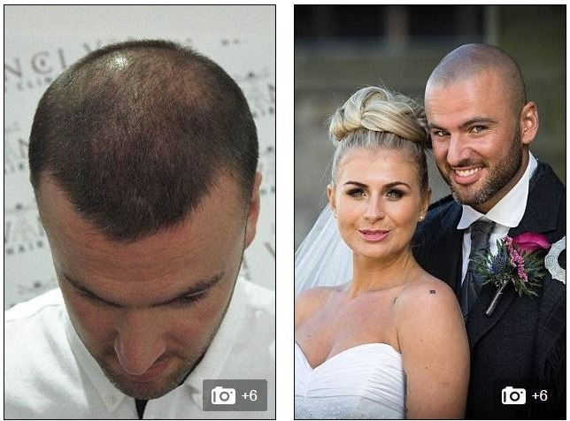 영국에서 유행중이라는 문신 | 인스티즈