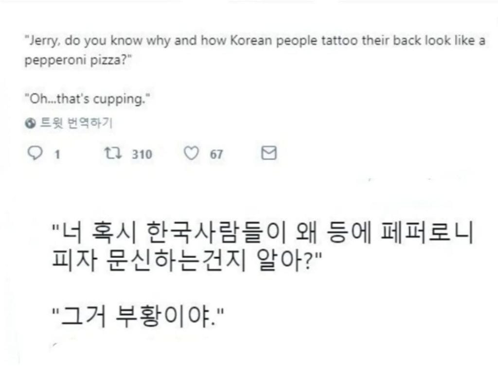 외국인이 보는 부항자국