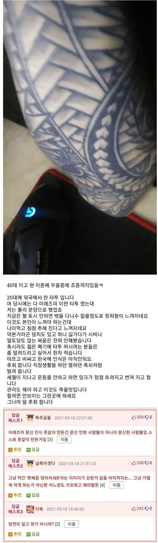 20대에 문신한 것을 후회하고 있는 40대