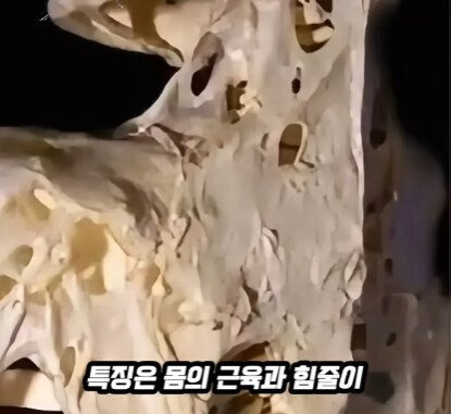 근육과 힘줄이 뼈로 변하는 질병