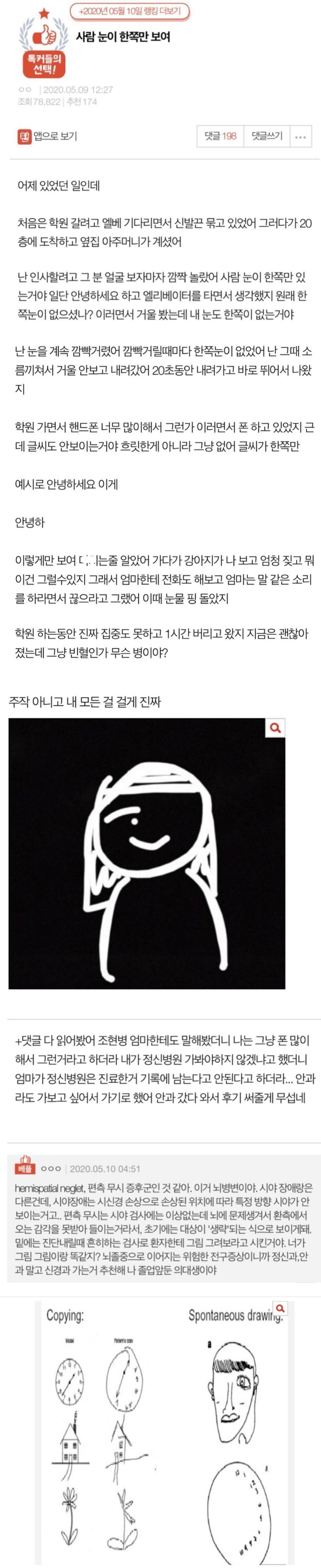 사람 눈이 한쪽만 보여