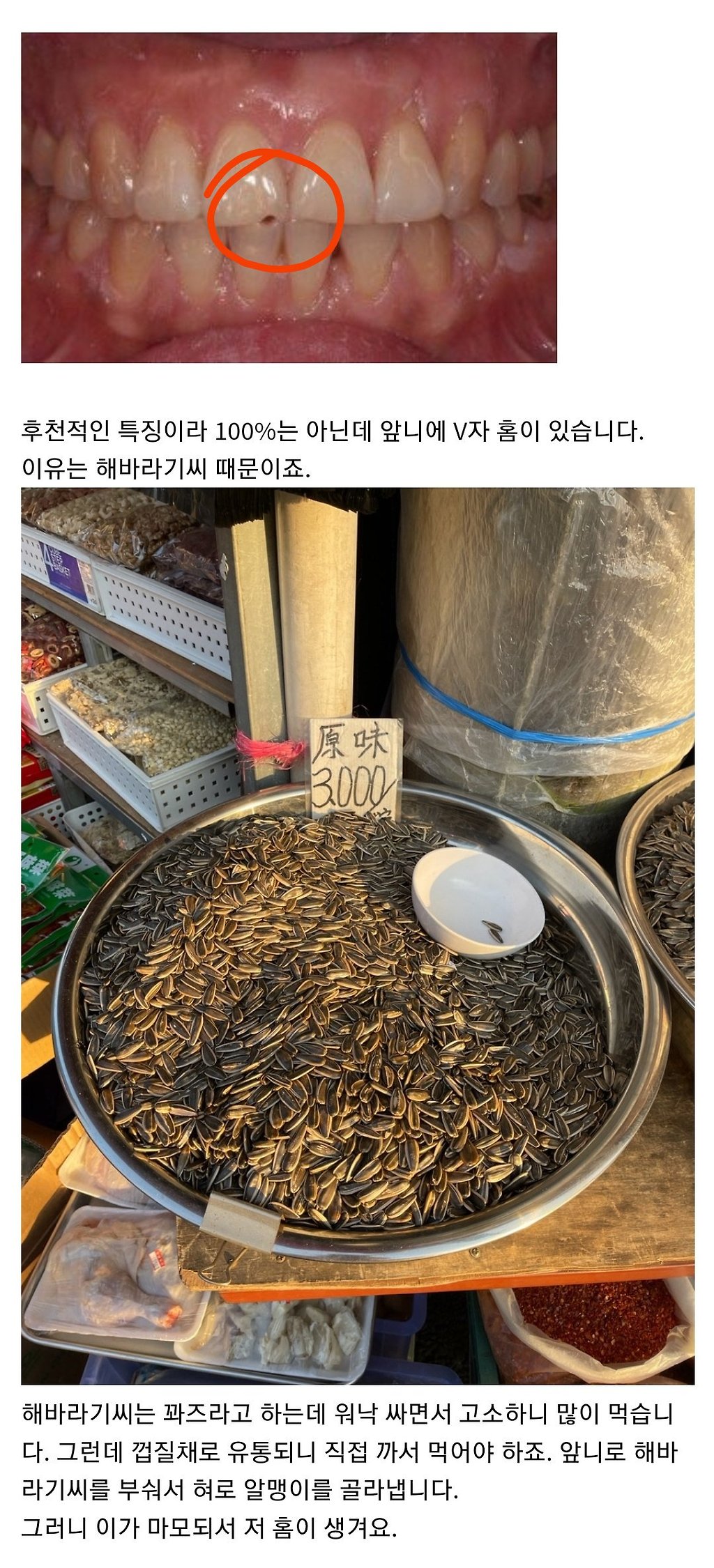 중국/소련권 국가 사람들에게만 있다는 신체적 특징.....jpg