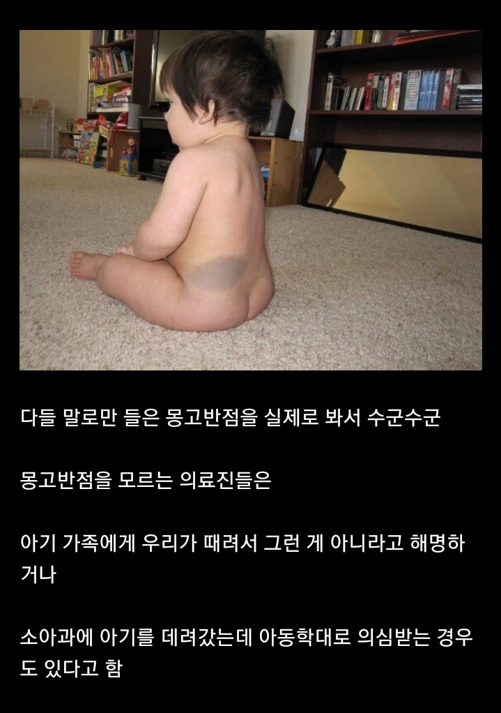 미국 산부인과에서 동양인 아기 태어나면 놀라는 이유