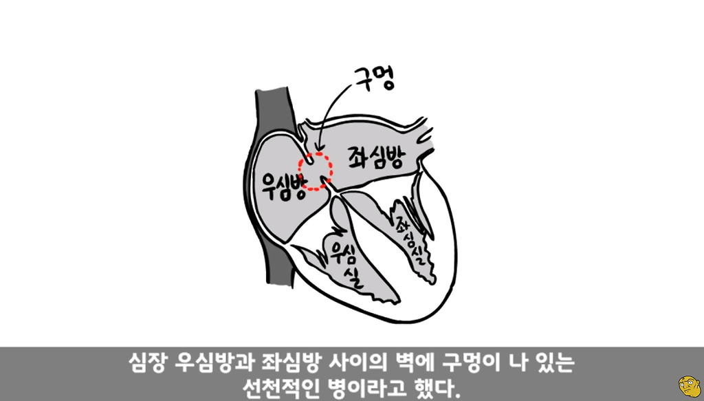 꾀병 부리고 3개월만에 전역한 훈련병