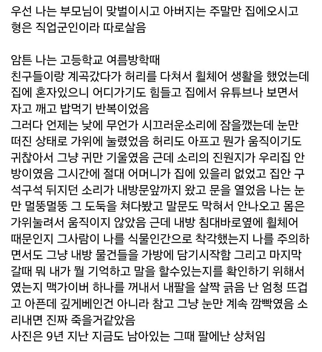 식물인간인 척해서 살은 사람