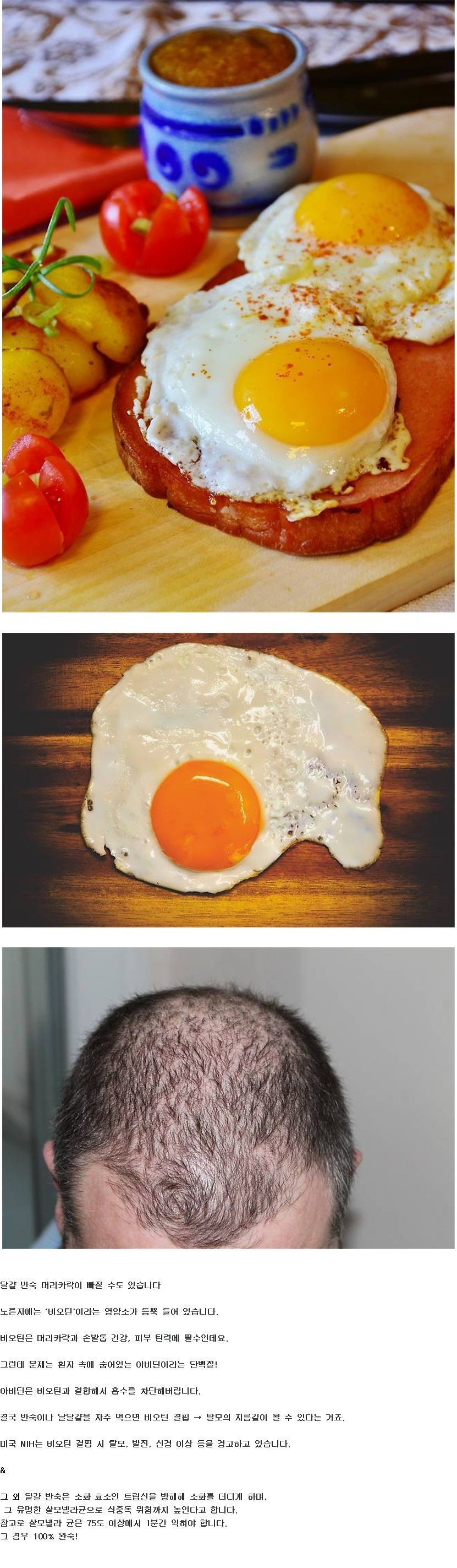 달걀 반숙 머리카락이 빠질 수도 있슴.