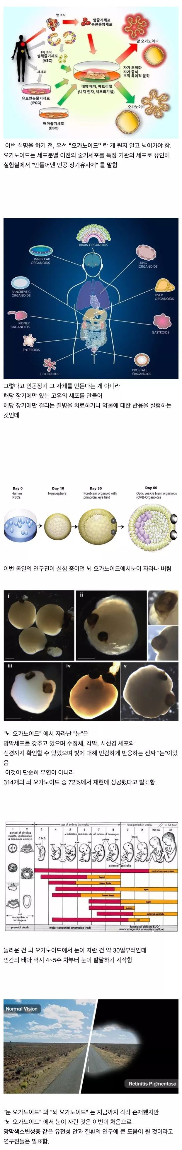 인공 뇌에서 눈 생성.