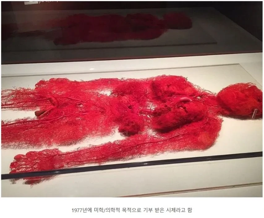 실제 사람의 핏줄 분포.
