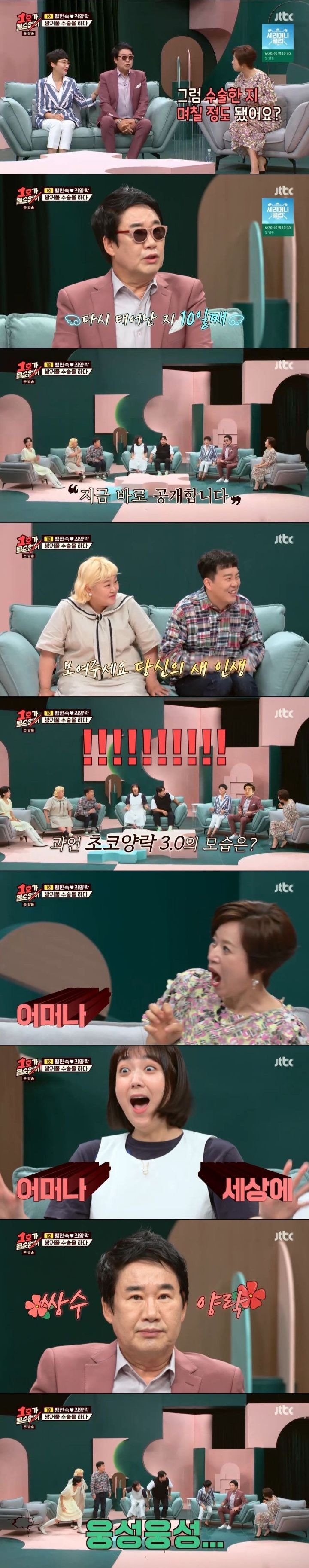 [유머] [유머]             최양락 쌍수 직후 &amp; 10일차 눈을 본 후배 개그맨들 반응. -  와이드섬