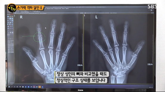 [유머] [유머]             손가락 격파의 달인. -  와이드섬