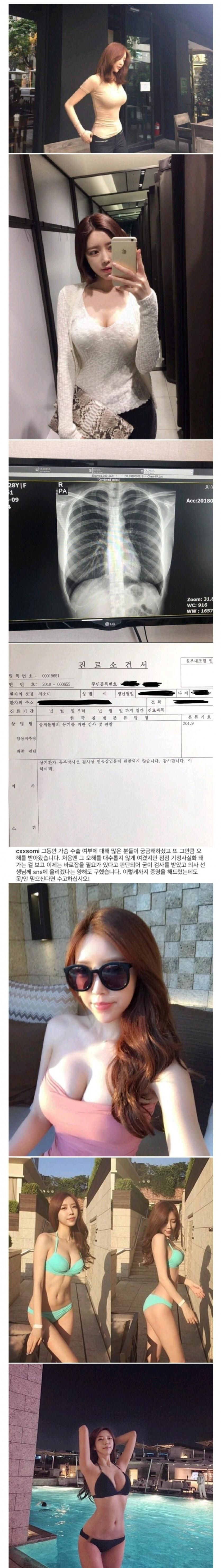 의젖 드립에 빡쳐서 참젖 인증했던 최소미 비키니 몸매.jpg