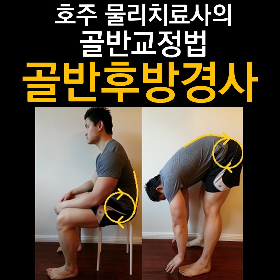 호주 물리치료사가 알려주는 체형교정법(골반 후방경사)