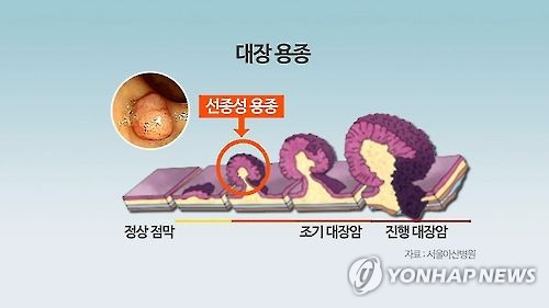 [연합뉴스TV 제공]