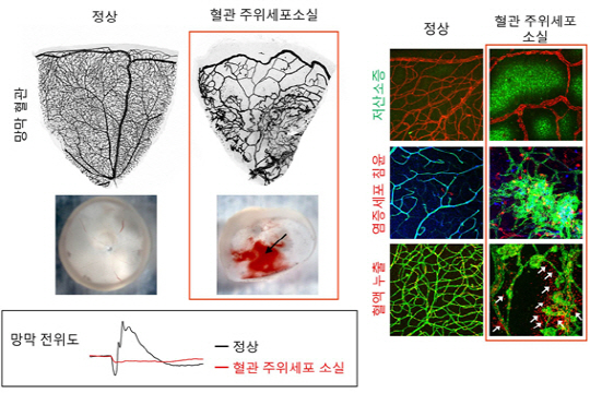 망막 혈관에서 정상적인 혈관 주위 세포를 제거할 경우, 굵고 불규칙한 모양의 혈관이 관찰되었다. 혈관 주위세포의 소실로 혈액-망막 장벽의 파괴된 망막은 저산소증, 혈액 누출 및 출혈 및 시각기능 소실을 보였다./사진제공=기초과학연구원