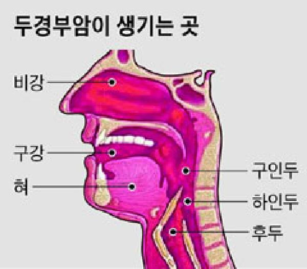 [헬스조선]김우빈이 투병중인 비인두암은 두경부암에 속한다. 두경부암은 치료가 까다로워 의사와 환자에게 모두 공포스러운 암으로 꼽힌다./사진=헬스조선 DB