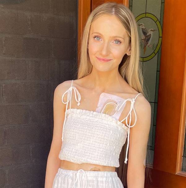 불치병을 앓고 있는 25세 호주 여성 애널리스 홀랜드는 존엄사를 택했다. 애널리스 홀랜드 인스타그램.