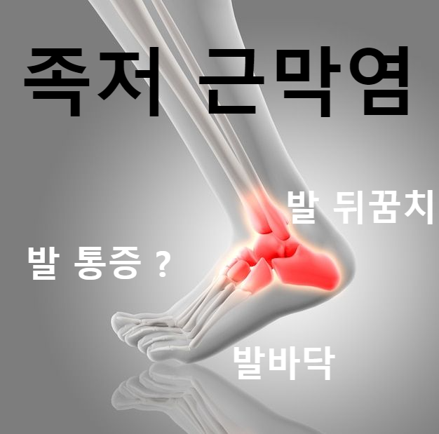 족저근막염 증상 원인 및 자가치료 - 발바닥 , 발뒤꿈치 통증