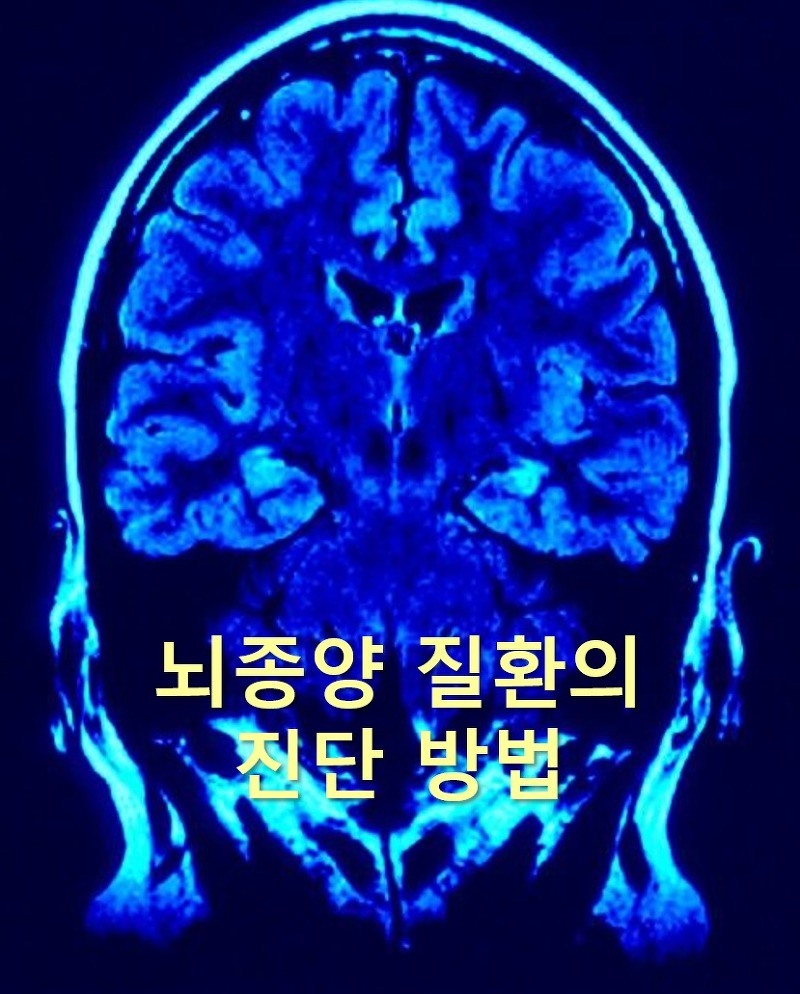 뇌종양 진단을 위한 뇌CT 검사와 뇌MRI 검사 방법