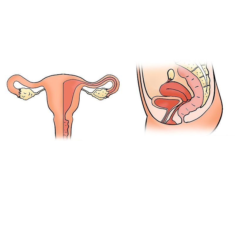 자궁경부암: 원인, 증상 및 예방에 대한 종합 가이드