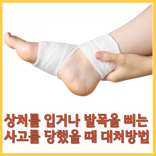 상처를 입거나 발목을 삐는 사고를 당했을 때 대처방법