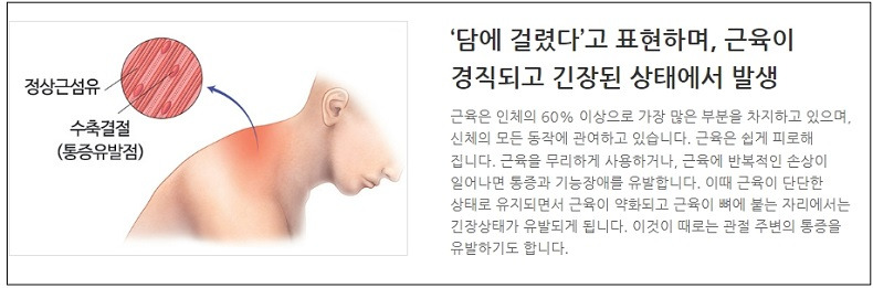 장시간 컴퓨터 스마트폰 사용으로 생기는 이 '통증'