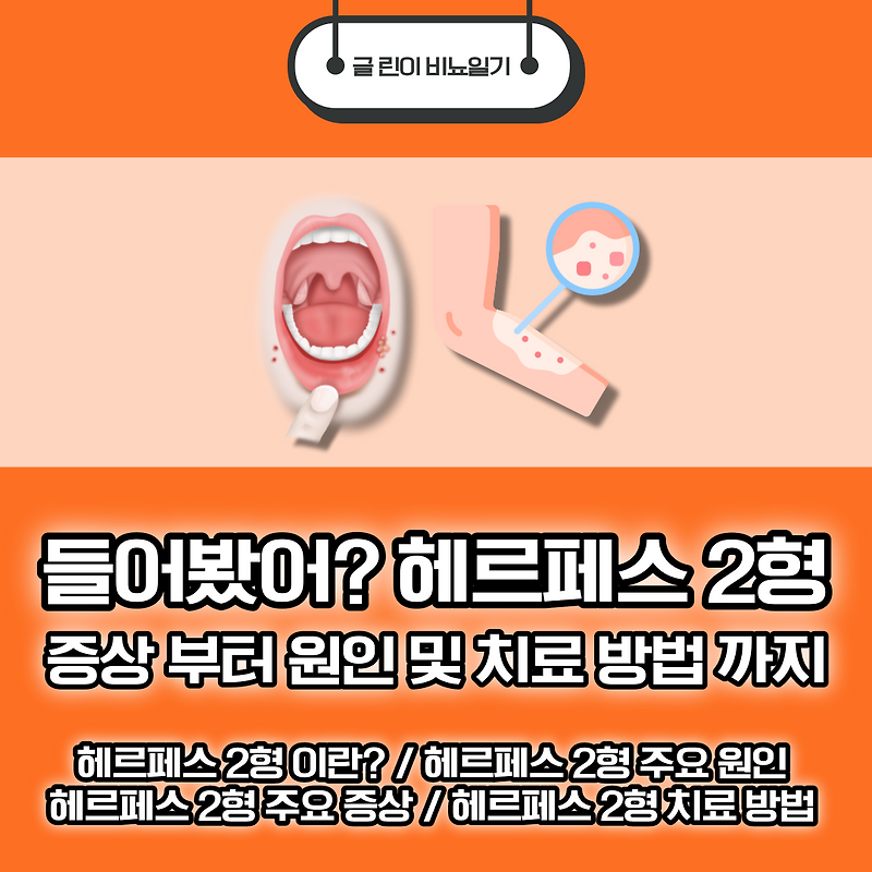 들어봤어? 헤르페스 2형 증상 부터 원인 및 치료 방법 까지