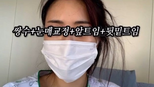 이세영, 드디어 쌍꺼풀 수술→앞트임까지…