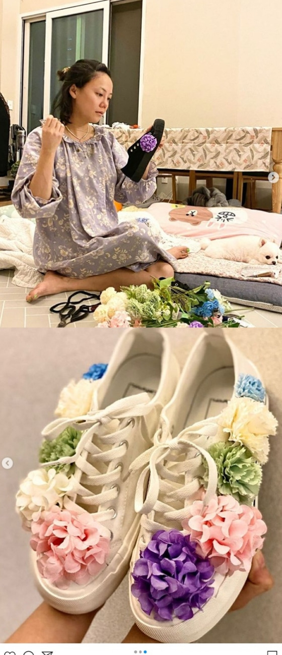 고은아, 모발 이식후 이마 깐 근황...확 달라졌네! [사진]