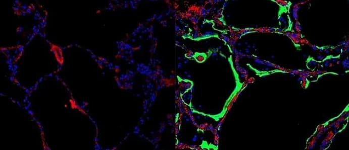 코로나와 싸우는 '폐 단백질' 발견 Australian scientists make a 'crazy interesting' Covid-19 discovery that could finally explain..