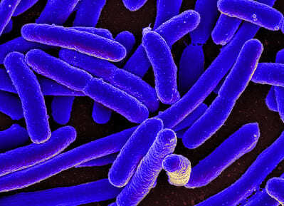 나쁜 세균 감염이 지속되는 이유 STUDY PROVIDES CLUES ON WHY SOME BAD INFECTIONS PERSIST