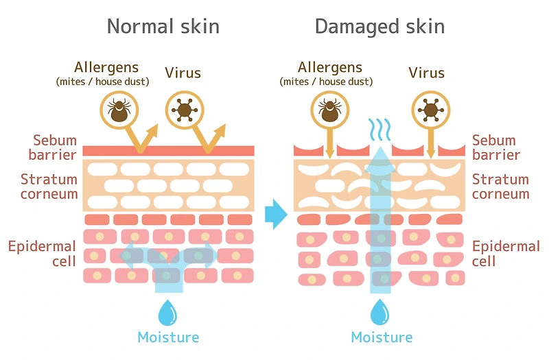 피부장벽이란? 지성 피부, 건성 피부, 복합성 피부, 민감성 피부 모두에게 중요한 피부장벽이 손상되는 원인, 피부장벽 지키는 너무 쉬운 습관들
