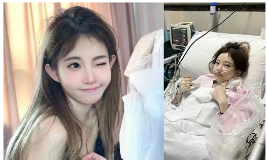 대륙여신 중국 인플루언서 여캠 펑티모 충격적 근황 '갑상선암 수술' 나이 프로필