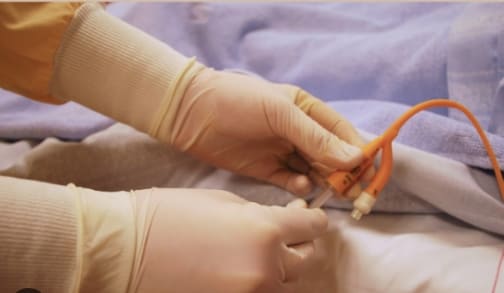 혈관 진입 미니 로봇, 수술 성공!(한양대팀) VIDEO: Small Magnetic Robot Completes Vascular Surgery