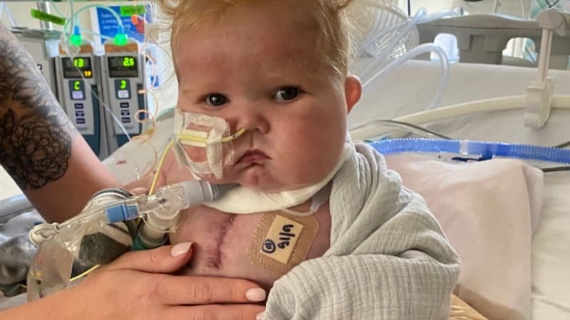 '세계 최초' 심장-흉선 이식 성공 'World-first' heart-thymus transplant success for Easton