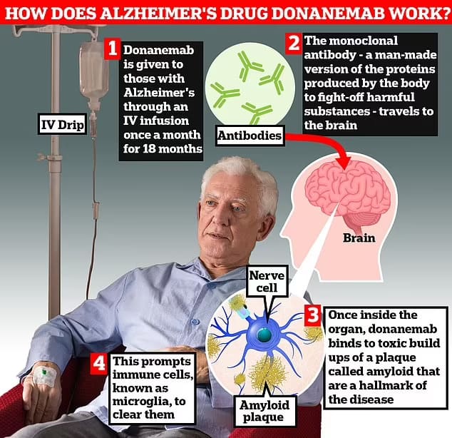 신약 '도나네맙(Donanemab)', 치매에 효과 입증 Drug donanemab seen as turning point in dementia fight