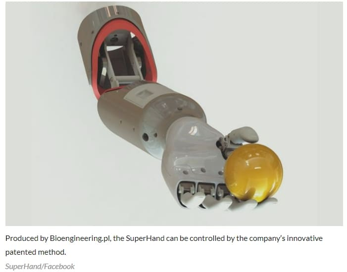 세계 최초 발로만 조종하는 생체 공학 팔 제작 World first: Wrocław scientists create bionic arm… steered by feet