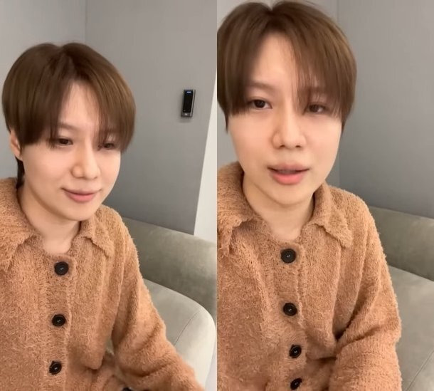 샤이니 태민 소집해제 살 진얼굴 10키로 증량 달라진 얼굴 무슨일