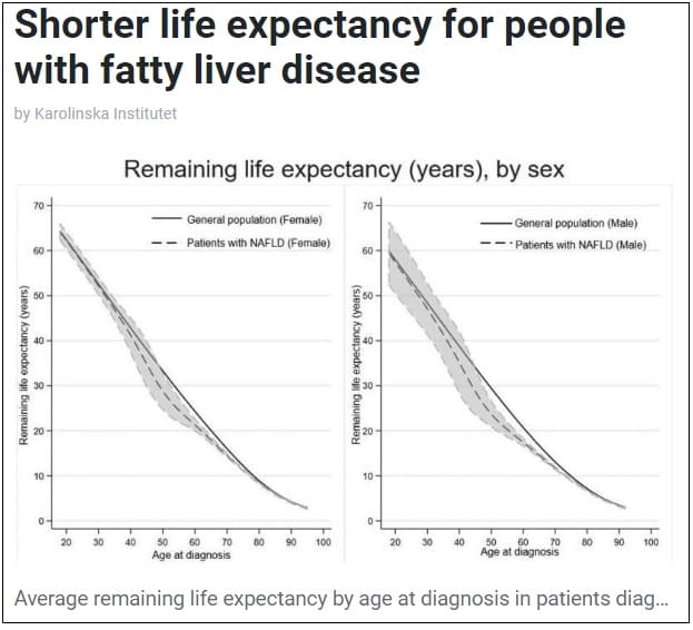 지방간 보유자, 3년 수명 짧아져 ㅣ 지방간 대책  Shorter life expectancy for people with fatty liver disease