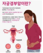 자궁경부암 예방접종 가격 및 시기