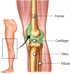 무릎 뒤쪽통증 원인, 관련된 질병, 치료 및 예방법에 대해서 확인해보세요