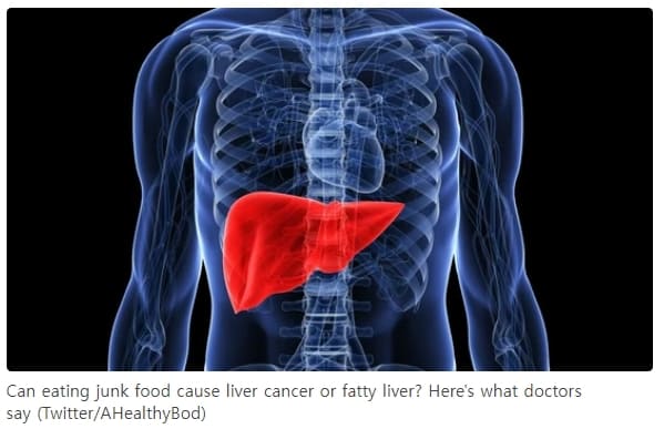 5년 안에 사망하는 간암...누가 왜 걸리나 ㅣ C형 간염 치료 후 암 추적 절차 크게 간소화 Researchers develop new stratification tool for liver cancer risk